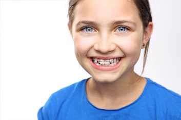 Ortodoncia infantil 6